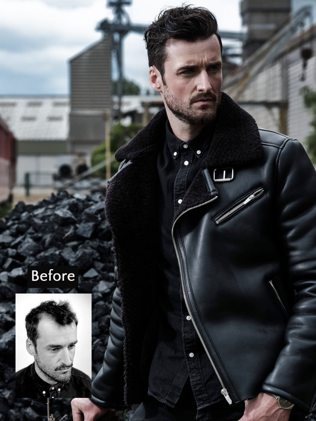 Comparing SensiGraft and Hairskeen