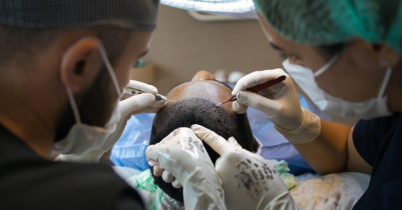 Hair Transplant Surgery Aftercare 9 Basic Steps