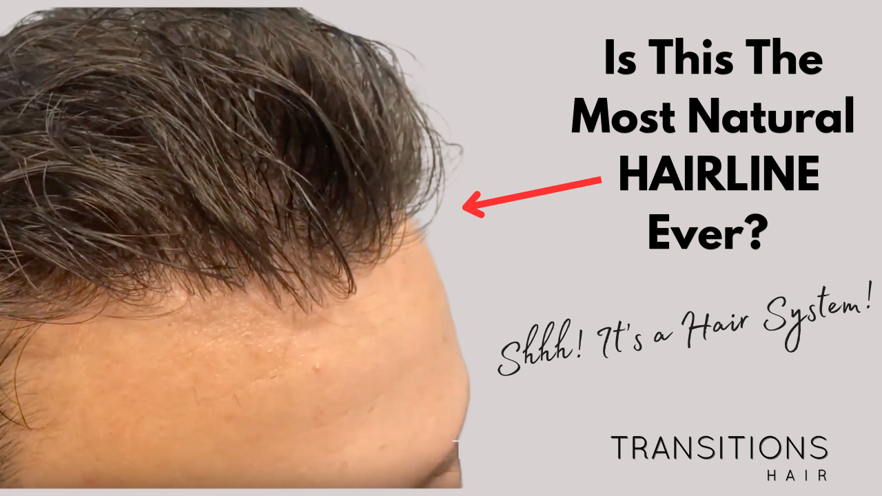 Video: Is This Australia's Most Natural Hairline? The Undetectable Hair System Revolution