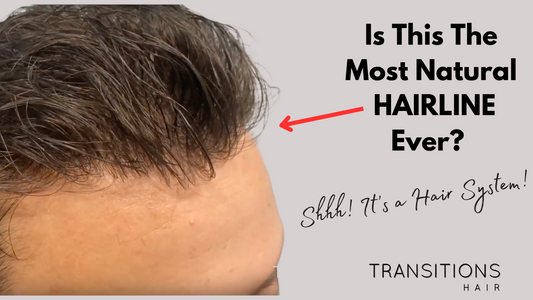 Video: Is This Australia's Most Natural Hairline? The Undetectable Hair System Revolution