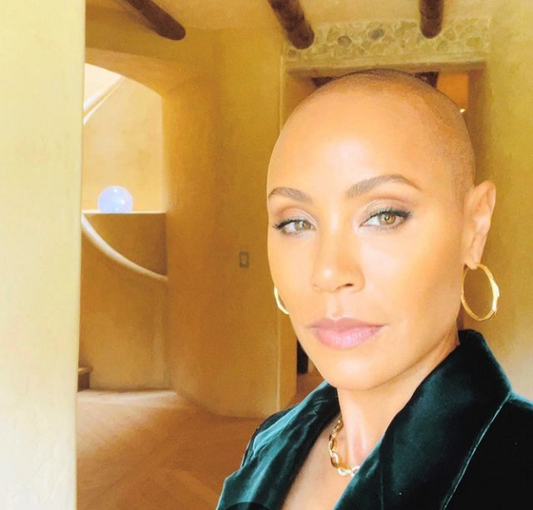 Alopecia & Jada Pinkett-Smith