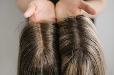 Hair Toppers Sydney Australia