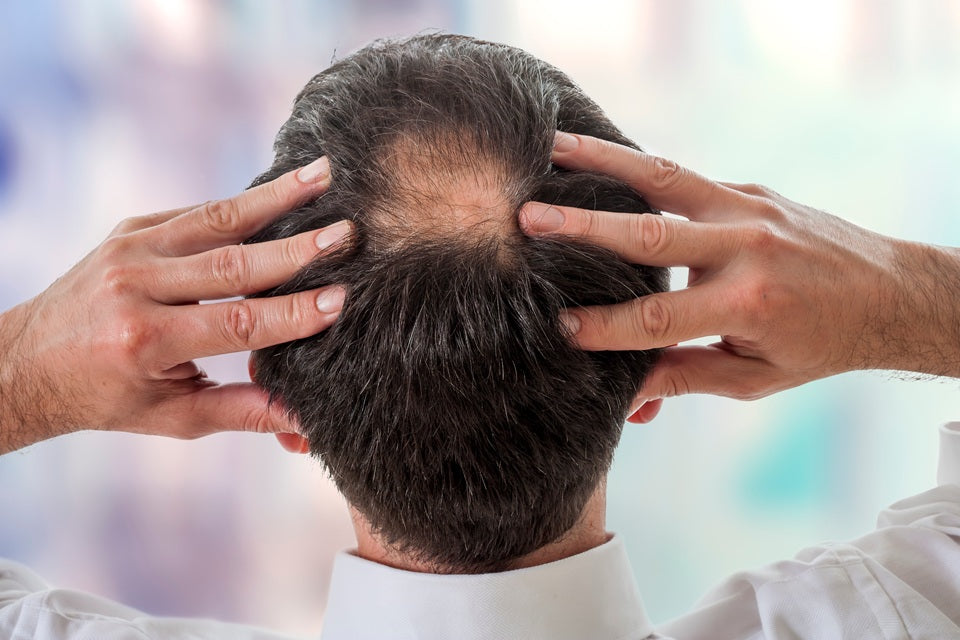 The Best Hair Products for Thinning Hair