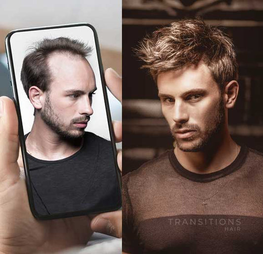 best mens hair replacement sydney nsw australia