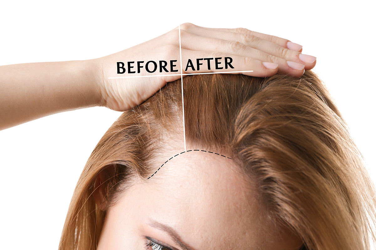 Maintaining Your Hair Topper: Tips and Tricks for Longevity