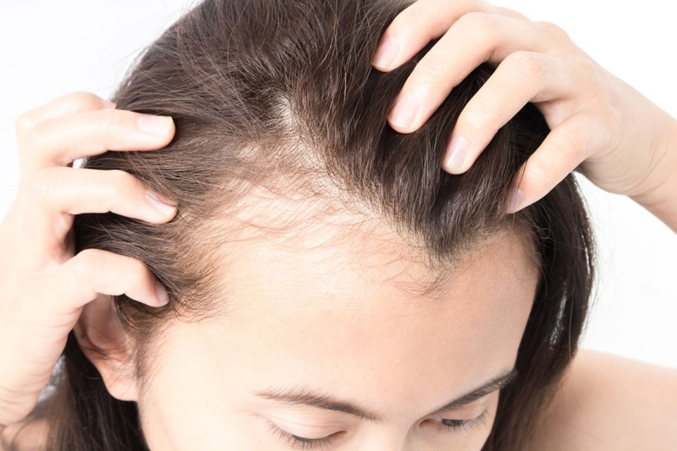 Noticed Hair Loss and Hair Fall? Your next steps: