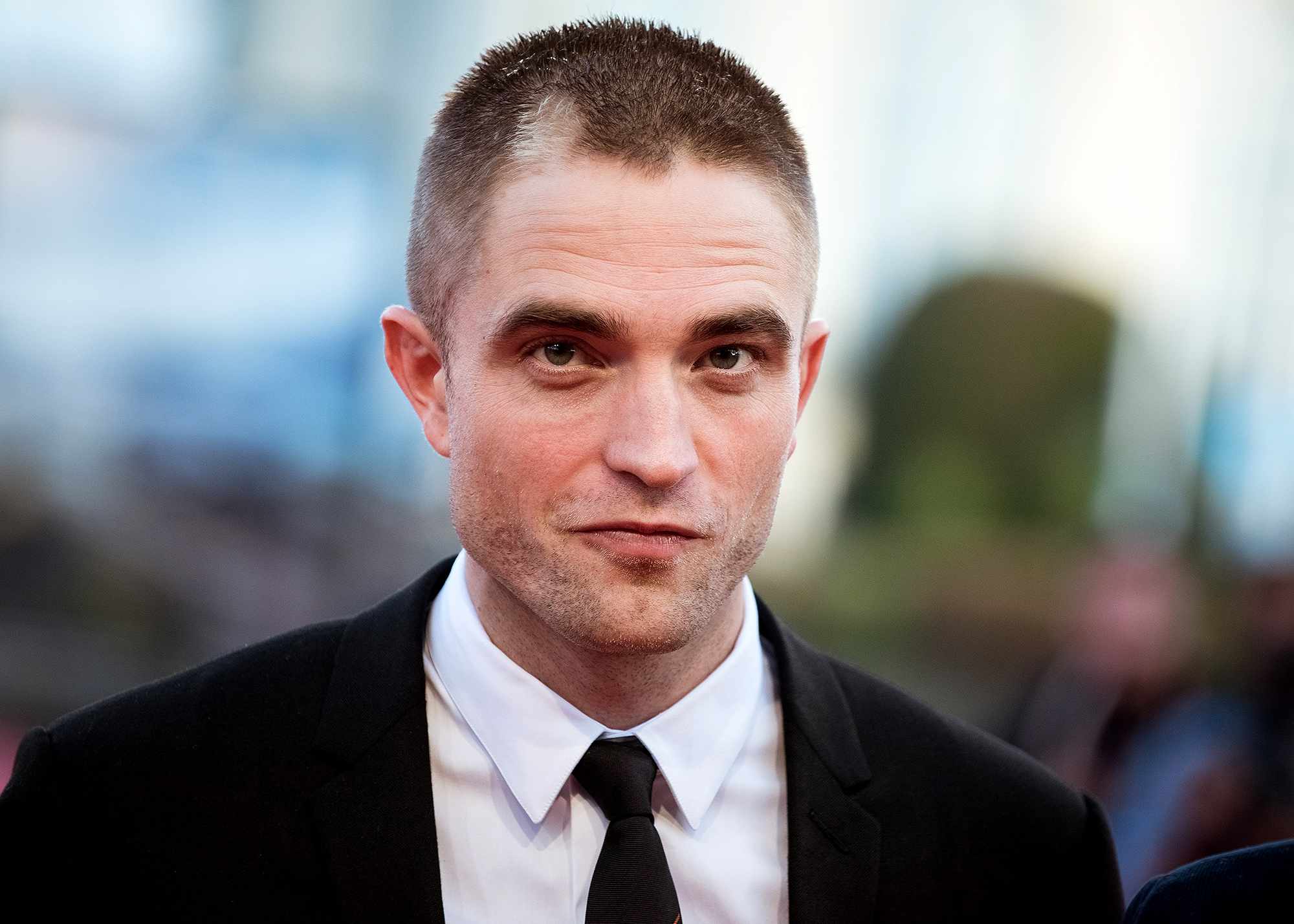 Robert Pattinson’s Hair Loss