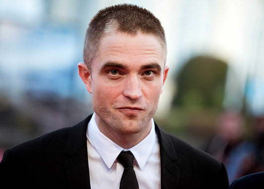 Robert Pattinson’s Hair Loss