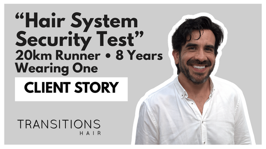 8 Years With a Hair System: What Confidence Looks Like in Real Life