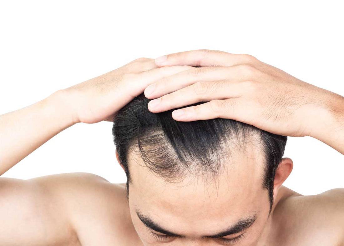 Toupees vs. Hairpieces: Decoding the Differences and Finding Your Fit