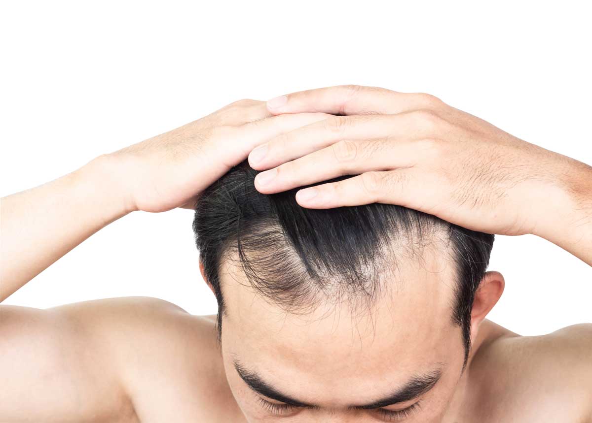 Toupees vs. Hairpieces: Decoding the Differences and Finding Your Fit
