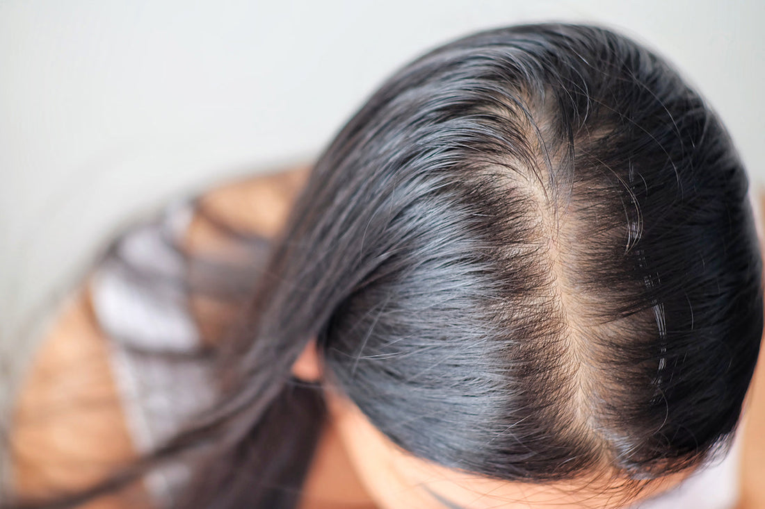 Hair Fall Root Understanding the Root of the Cause: Hair Loss in Women