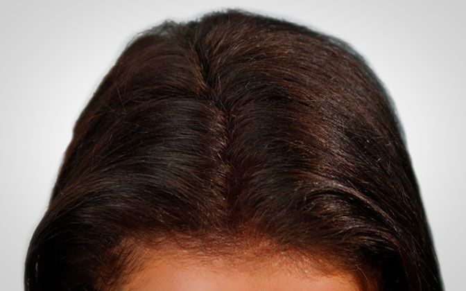 BioTHIK Women Hair Fibre's | Hair Thickener - Transitions Hair