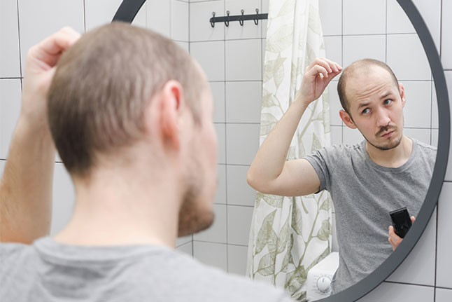 Men's Hair Transplants & Replacement - Transitions Hair