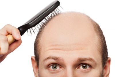 7-hair-loss-treatments