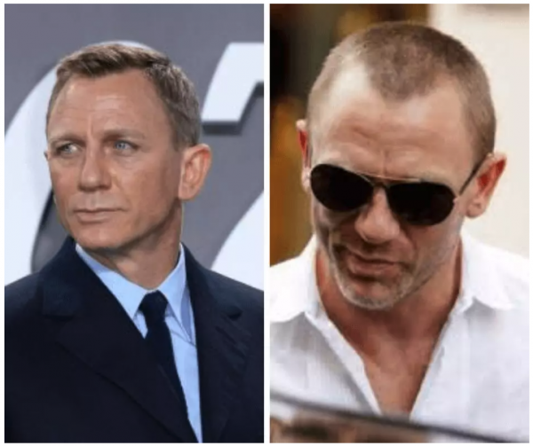 Daniel Craig hair loss