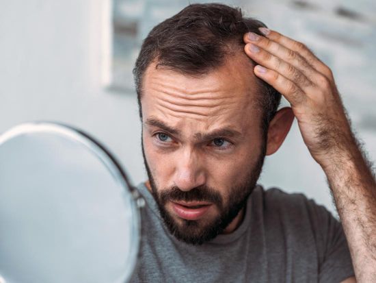 man experiencing hair loss