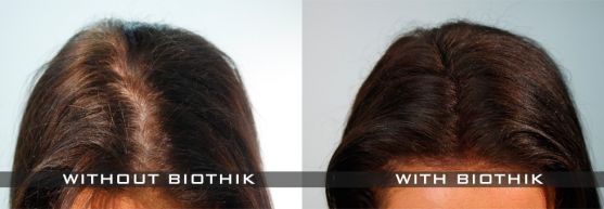 biothik before and after